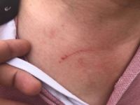 合约期内暴力解约、打伤员工，业主你是有多野蛮