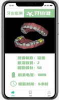 大学生创业团队研发”牙菌斑检测仪“：新一代智能健康家