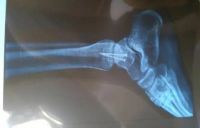 浴室细节很重要，防跌倒是关键！