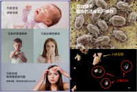 大宇“暴吸大喇叭”除螨仪，打造“没螨”生活