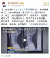 别让颈椎承受不可承受之重，SKG帮你缓解