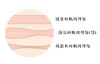 SKG按摩筋膜枪，健身房的放松好伴侣