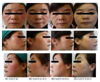 康芙美甘草精华液：敏感肌的克星，一瓶对抗N种“肌肤病”