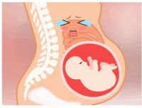 孕期难言又常见的烦恼，试试米诺斯“轻水疗”马桶