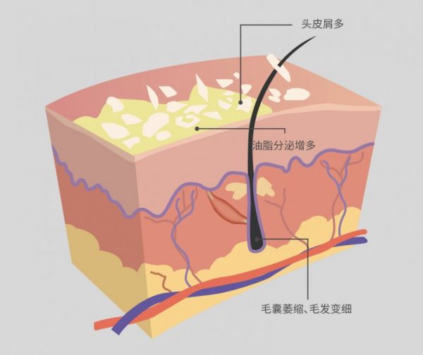 1.5异常痒.jpg