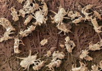 使用3个月的毛巾藏有10000+细菌？你真的需要一台艾芬达电热毛巾架！