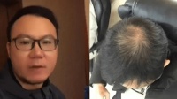 艾诗摩尔射频健发梳相信科技的力量！