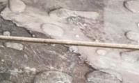 头疼！美缝又“白白”了！